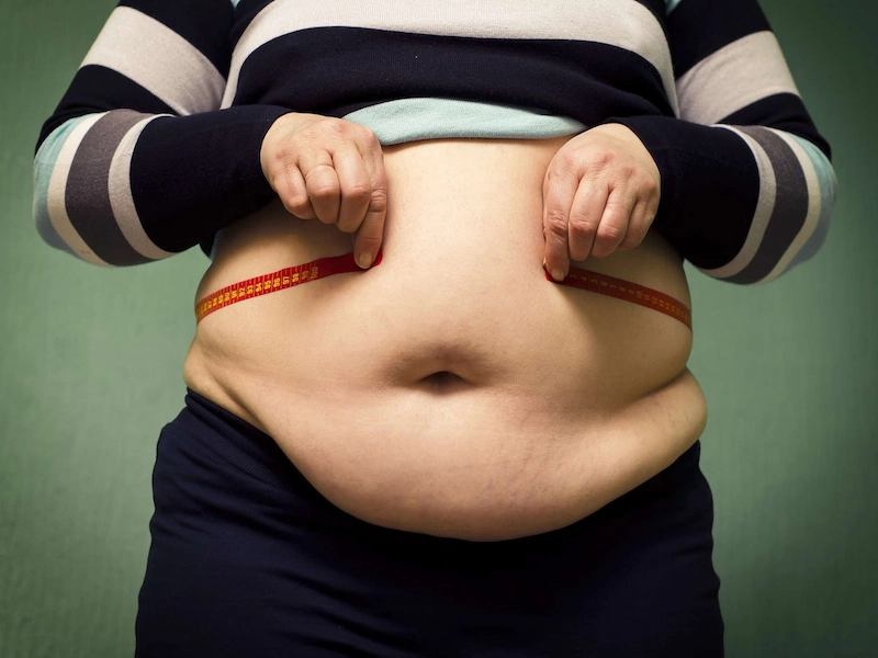 Obesity, variety of diseases caused by being overweight