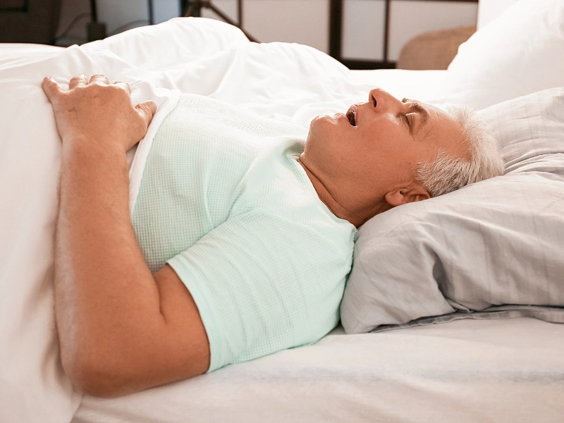 How does bariatric surgery affect sleep apnea?