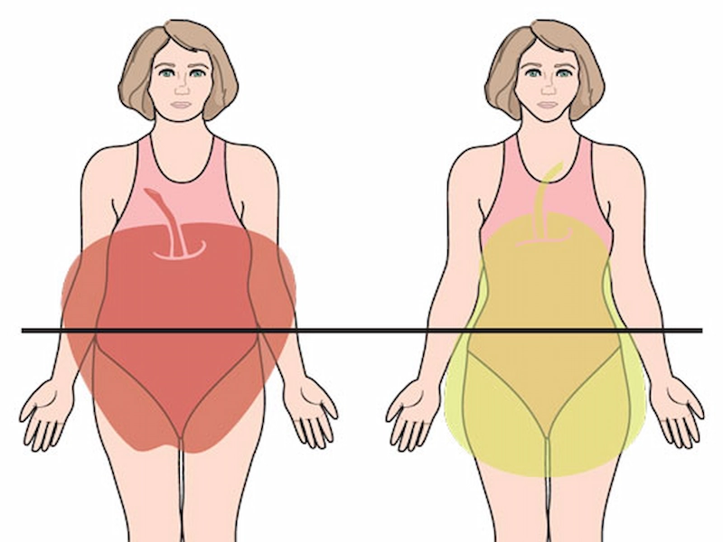 Apple-shaped obesity