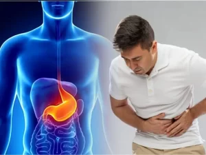 Stomach ulcer during diet
